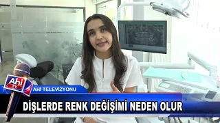 DİŞ HEKİMİ EDA ÇAM DİŞLERDE RENK DEĞİŞİMİ NEDEN OLUR SORUSUNU